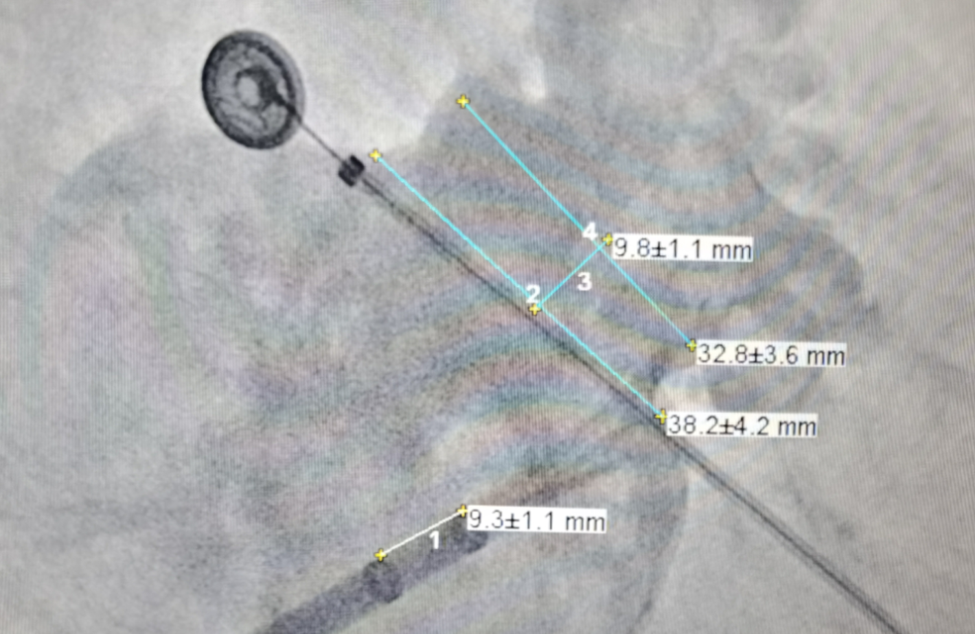 QQ截图20210305151701.png QQ截图20210305151701.png