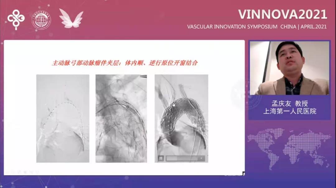 1621068vxx 1621068vxx