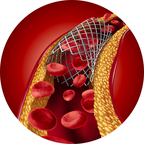 blood-vessel